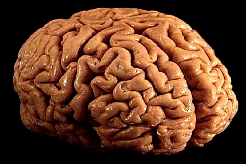 Science Explains Why Asians Have Bigger Brains Than Europeans and Africans