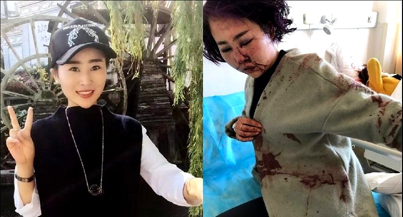 Chinese Woman’s Brutal Assault Finally Gets Justice After Her Story Goes Viral