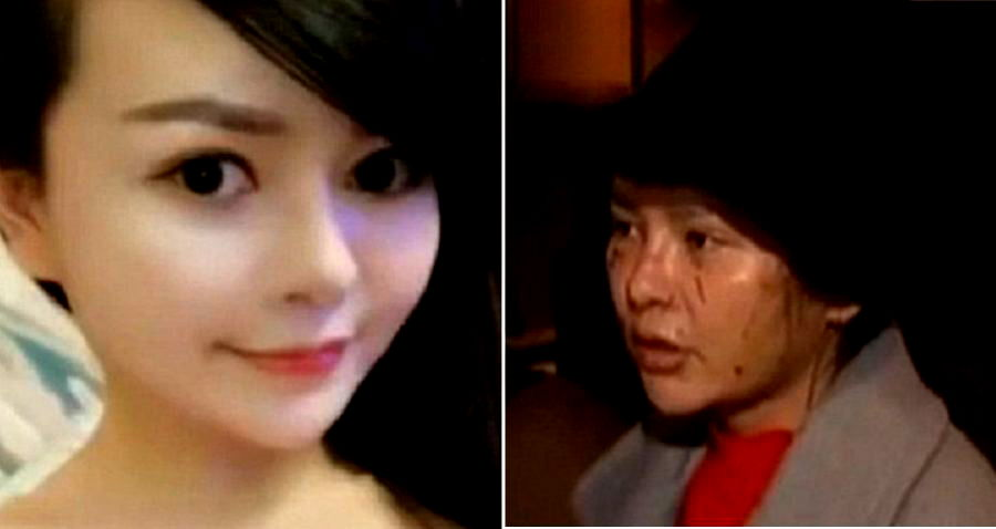 Chinese Woman Claims Her Best Friend Disfigured Her Beautiful Face Out of Jealousy
