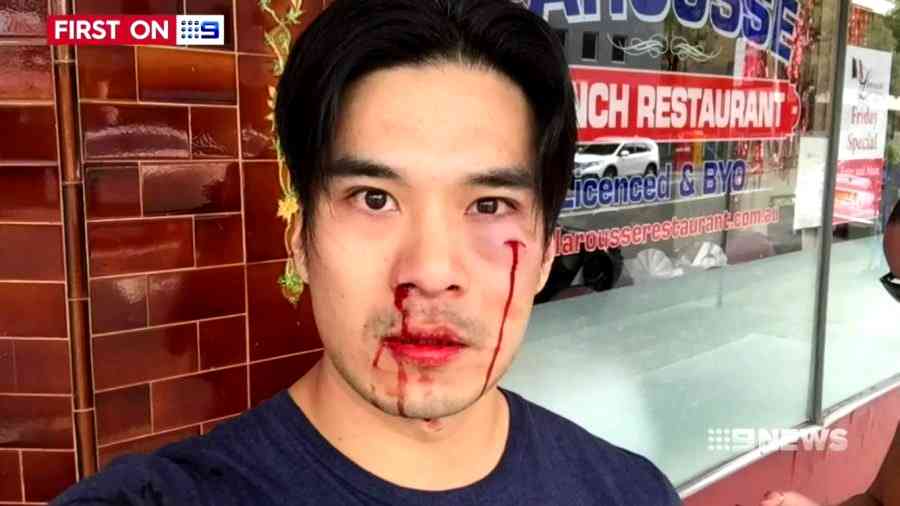 Asian-Australian Model Brutally Assaulted By Road Raging Driver