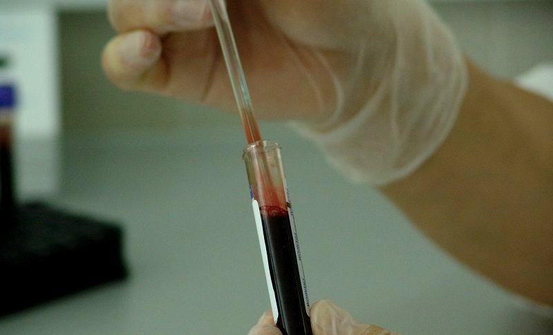 Chinese Hospital Accidentally Infects 5 Patients with HIV