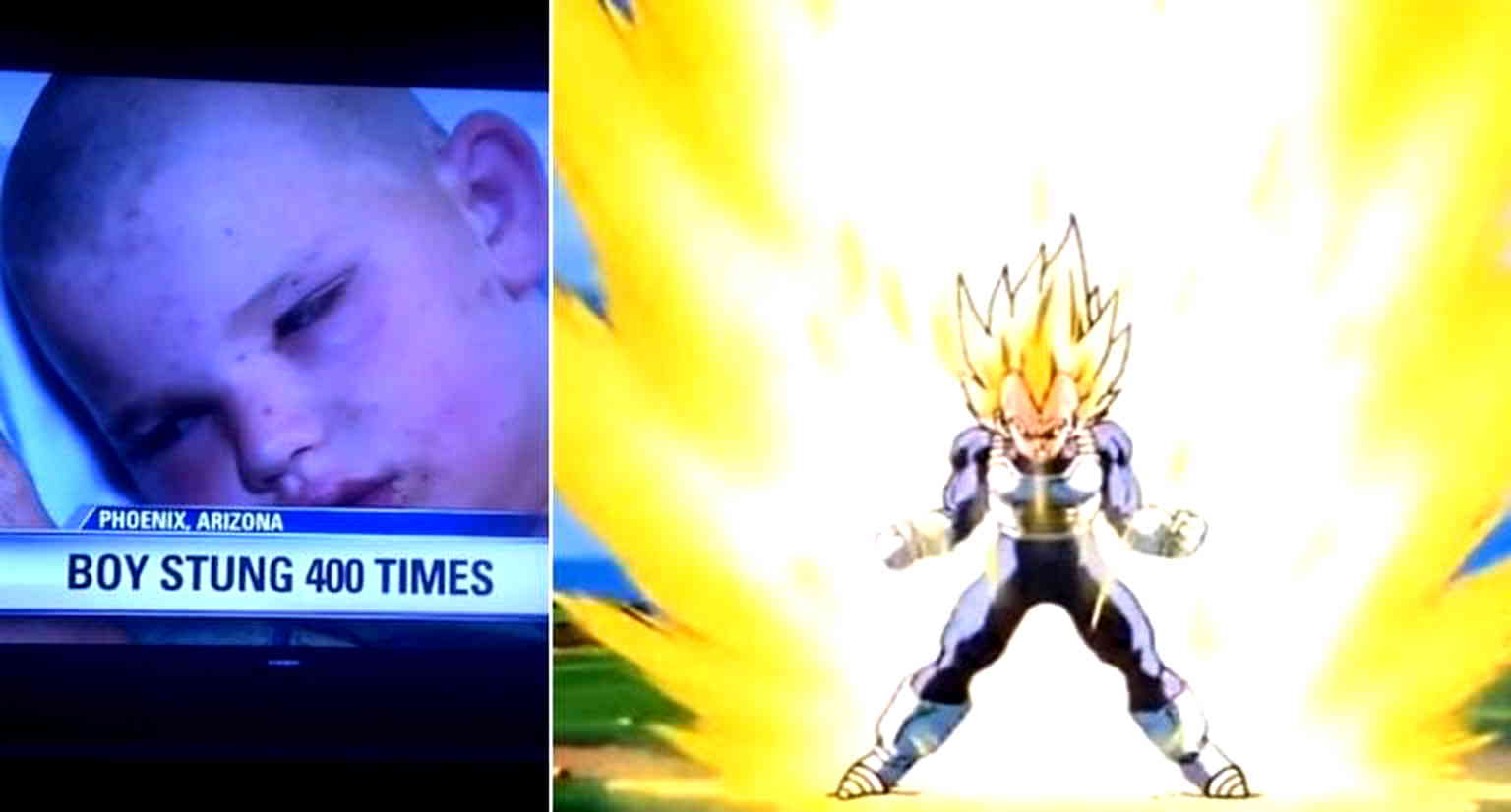 ‘I’m Andrew, but you can call me Vegeta’ Says Little Boy Stung 400 Times By Killer Bees