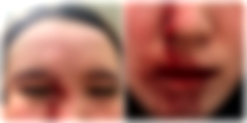 Australian Man Assaults Chinese Woman, Tells Her to ‘Get Out of MY Country’