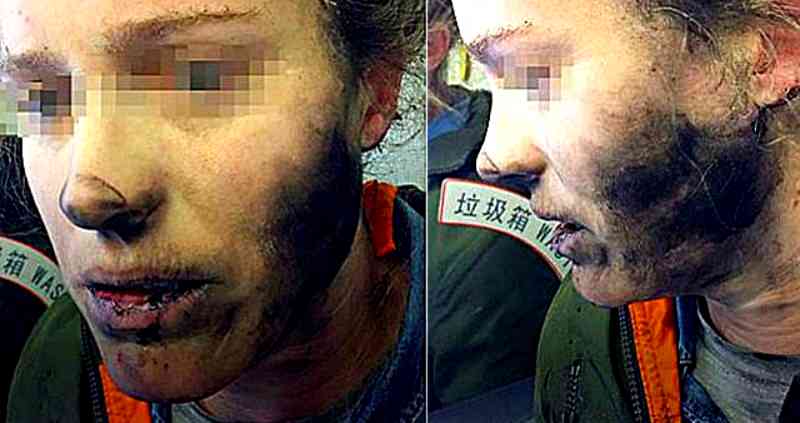 Sleeping Passenger’s Headphone Batteries Explode on Flight from Beijing