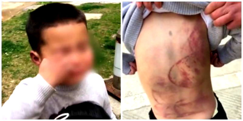 6-Year-Old Chinese Boy Sleeps Under A Car Because His Dad Won’t Stop Beating Him