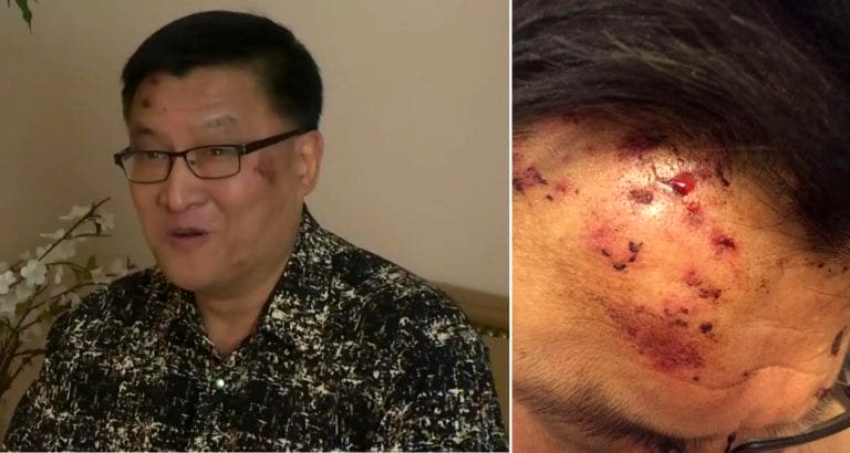 Mall Security Allegedly Assaults 54-Year-Old Asian Man Getting a Refund at Zara