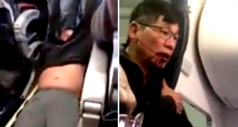 New Report from Aviation Officer Claims Dr. Dao’s Bloody Face Was His Fault