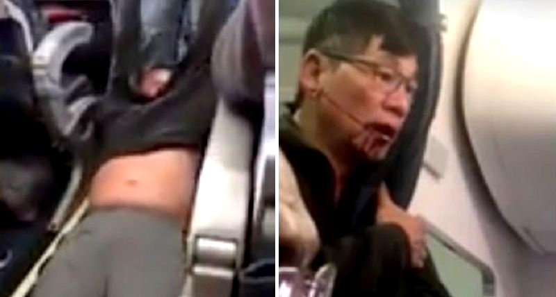 New Report from Aviation Officer Claims Dr. Dao’s Bloody Face Was His Fault