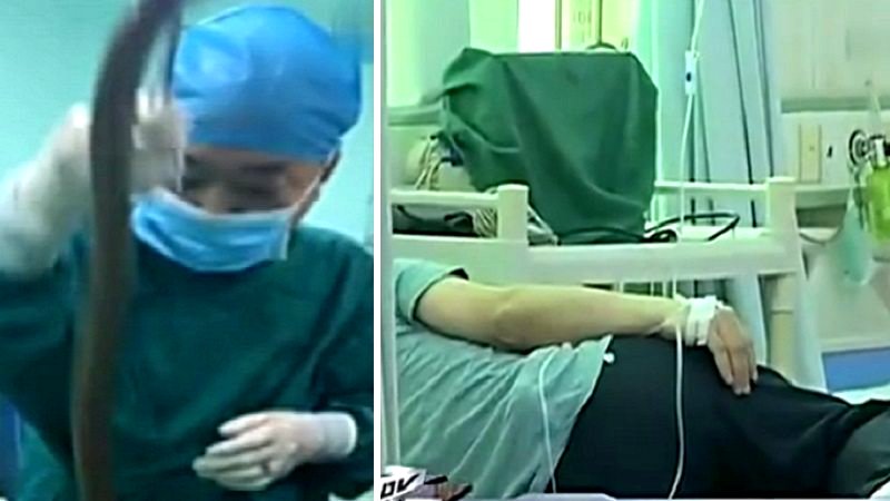 Constipated Chinese Man Tries to Cure Himself by Shoving an Asian Swamp Eel Into His Anus