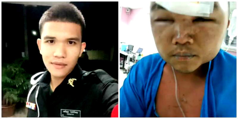 Thai Army Recruit Allegedly Beaten to Death for Waking Up Late