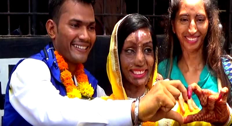 Acid Attack Victim Finds True Love After Dialing the Wrong Number