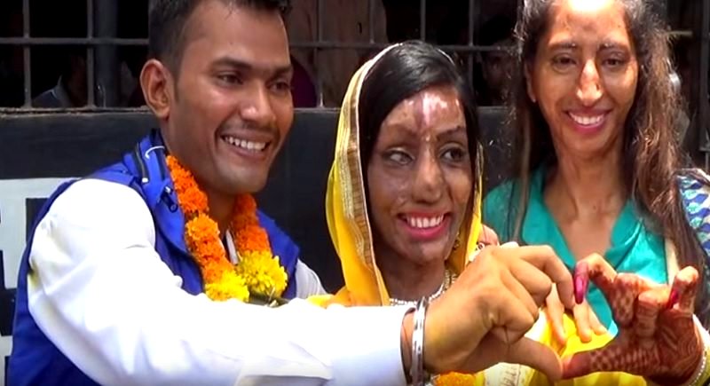 Acid Attack Victim Finds True Love After Dialing the Wrong Number