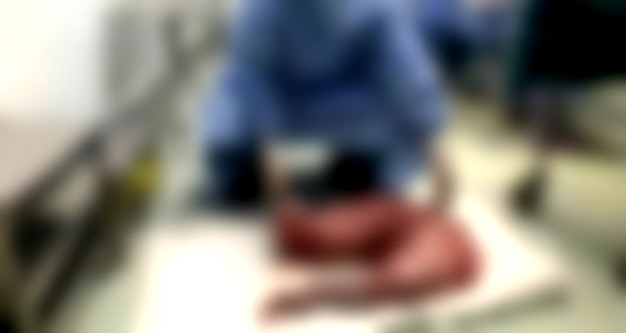 Chinese Surgeons Remove 30 Inches of Man’s Intestines to Relieve Painful Constipation