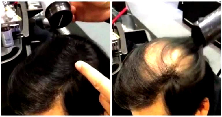 Japanese Twitter Goes Crazy Over Hair Product That Magically Covers Bald Spots