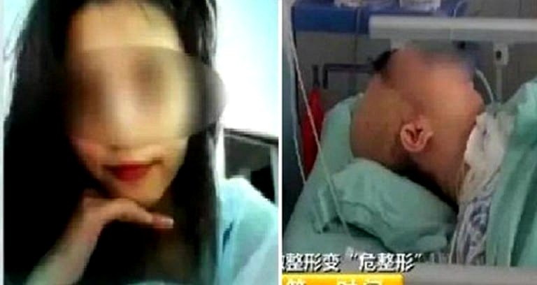 Botched Plastic Surgery Leaves Woman Paralyzed, in a Coma in China