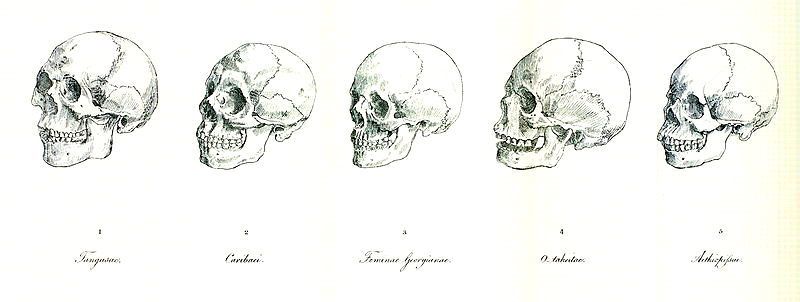 phrenology