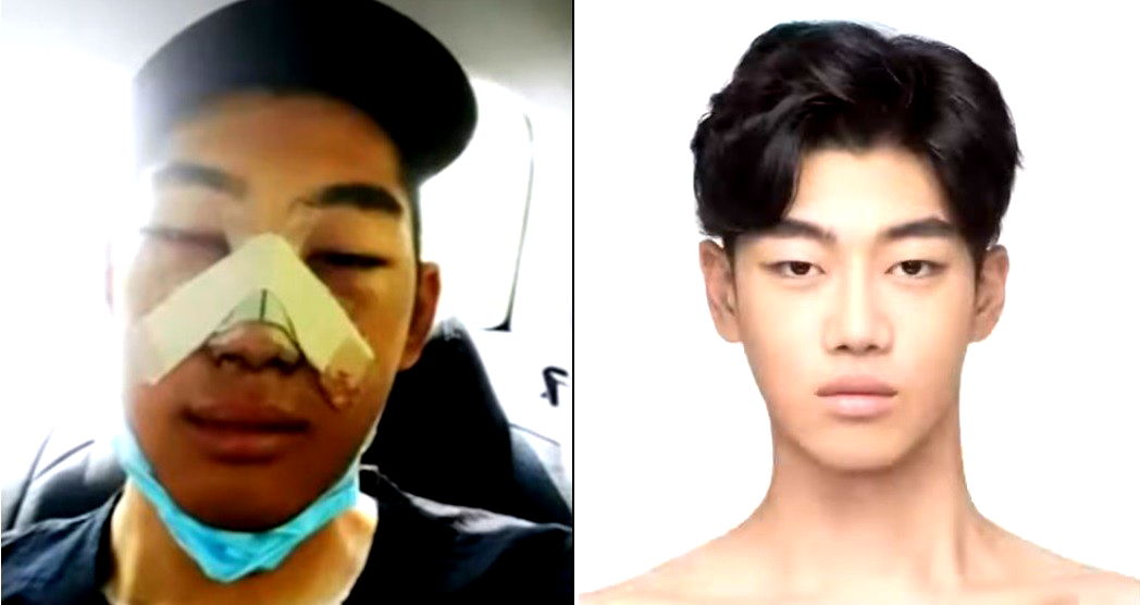 More South Korean Men Are Having Plastic Surgery to Look ‘Pretty’ Like K-Drama Actors