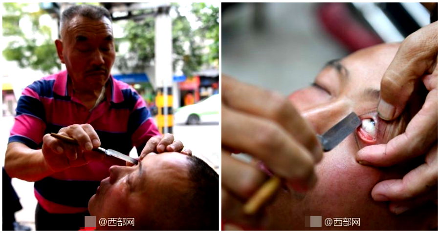 Elderly Chinese Man ‘Cleans’ People’s Eyes With a Sharp Razor Blade