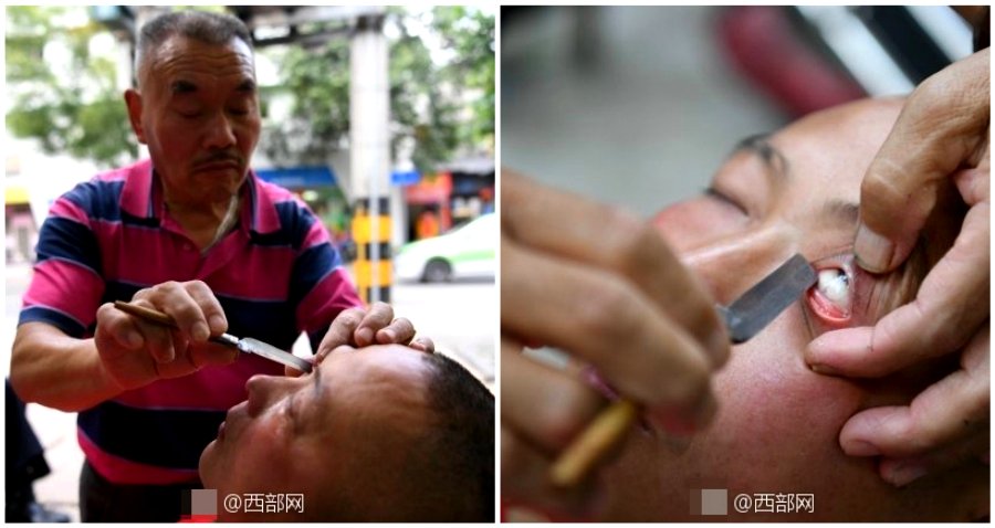 Elderly Chinese Man ‘Cleans’ People’s Eyes With a Sharp Razor Blade