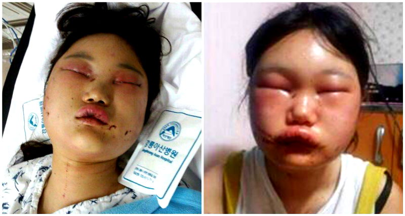 Another Korean Girl Viciously Beaten, Sexually Harassed By School Bullies in Viral Incident