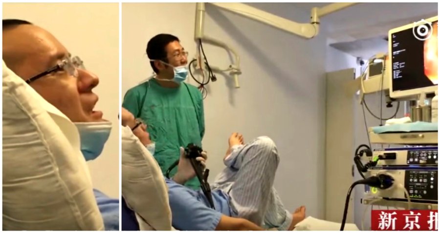 Chinese Doctor Performs Colonoscopy on Himself to See How Crappy it is For Patients