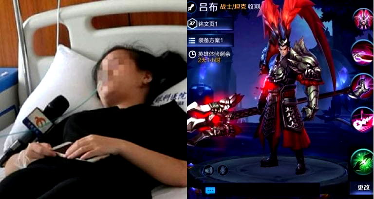 Woman in China Goes Blind in One Eye After Playing Mobile Games For Entire Day