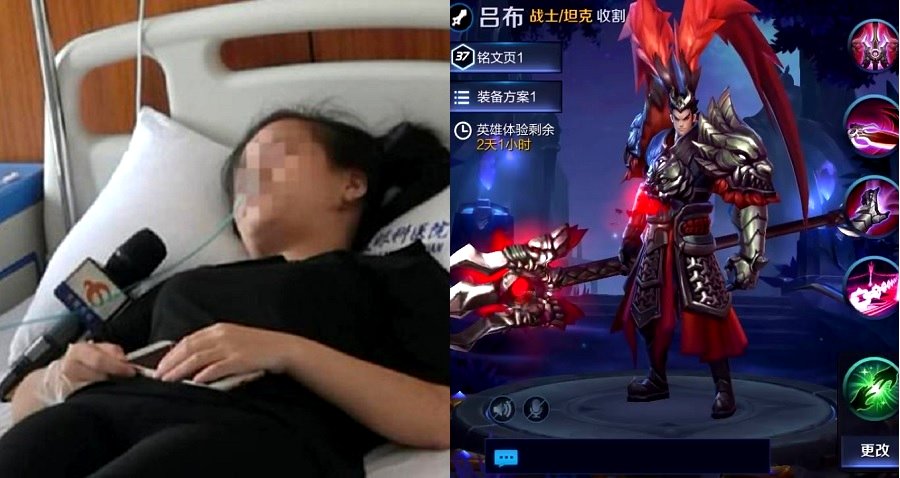 Woman in China Goes Blind in One Eye After Playing Mobile Games For Entire Day