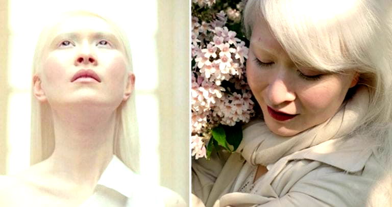 Meet The World’s First Albino Fashion Model From Hong Kong