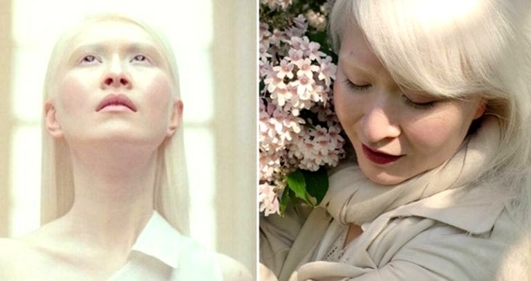 Meet The World’s First Albino Fashion Model From Hong Kong