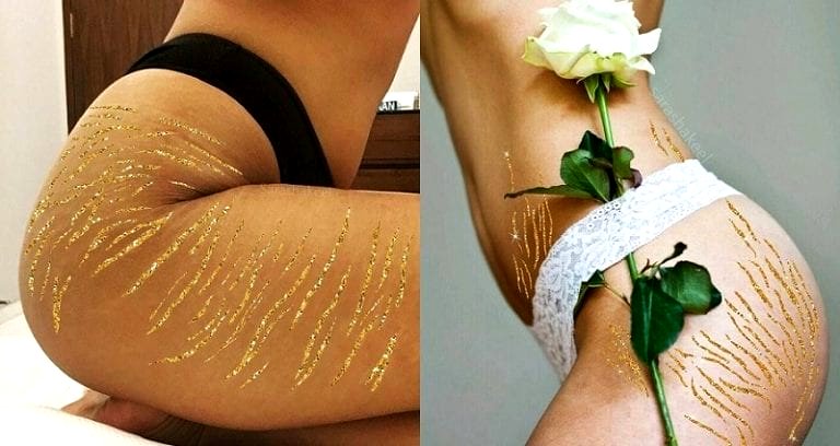 Pakistani Woman Uses Japanese Art Style to Turn Stretch Marks Into Works of Art