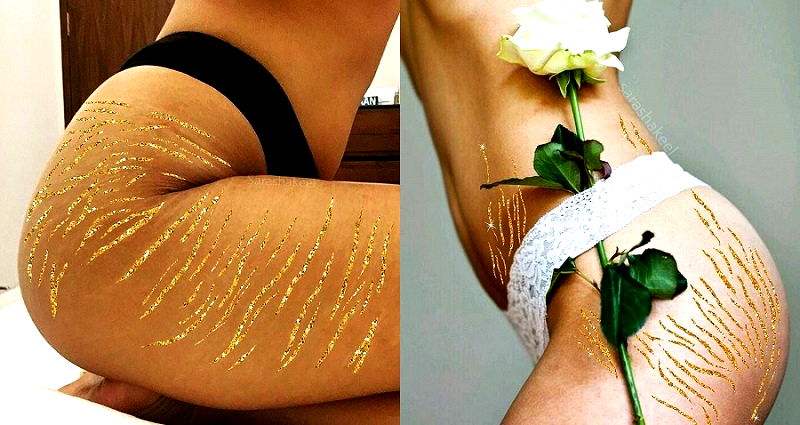 Pakistani Woman Uses Japanese Art Style to Turn Stretch Marks Into Works of Art