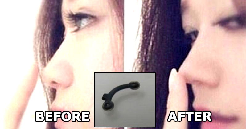 Korean Women Are Putting Pegs Up Their Noses to Look More ‘Caucasian’ in Dangerous Beauty Trend