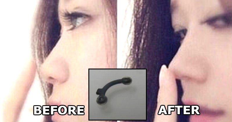 Korean Women Are Putting Pegs Up Their Noses to Look More ‘Caucasian’ in Dangerous Beauty Trend