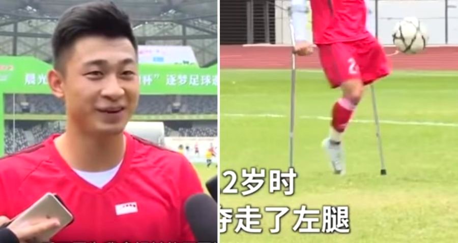 Chinese Soccer Player Goes Viral For Playing With Only One Leg