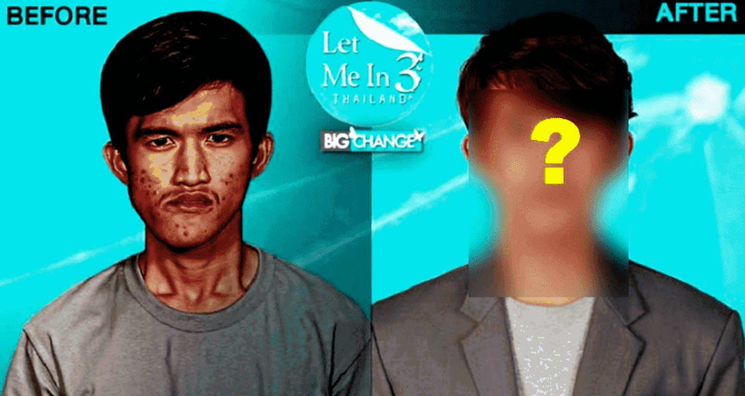 Thai Makeover Show Gives Man With Disfigured Jaw the Most Epic Transformation