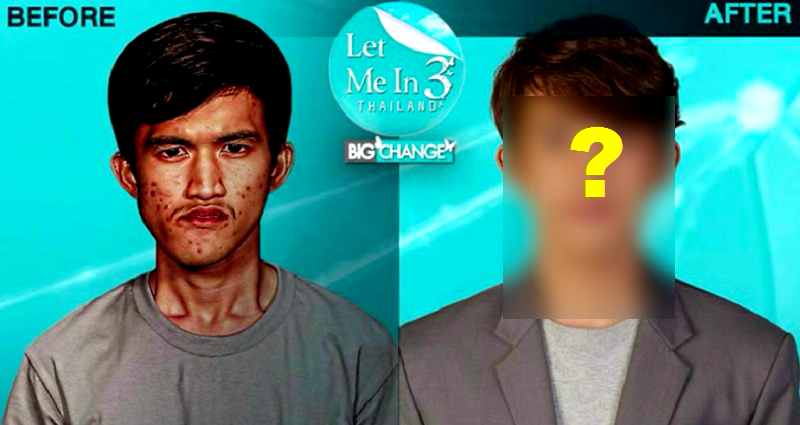 Thai Makeover Show Gives Man With Disfigured Jaw the Most Epic Transformation