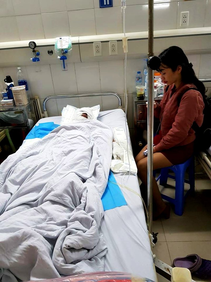 vietnamese woman in a coma after being burned