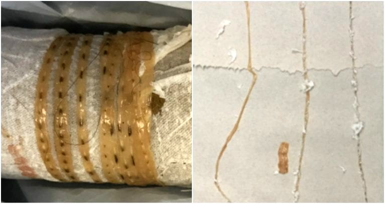 5-Foot Tapeworm ‘Wiggles Out’ of Man’s Butt After Eating Sushi in California