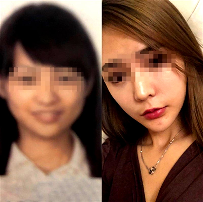 Chinese Plastic Surgery