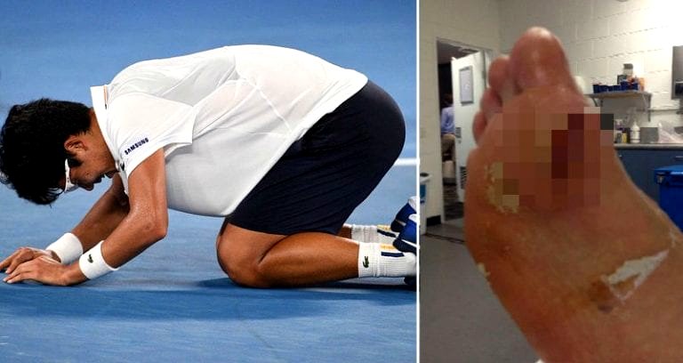 Blister Forces Tennis Star Hyeon Chung to Forfeit the Australian Open