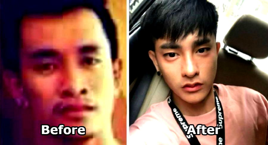 He Had 30 Plastic Surgeries to Become a ‘Korean’ Star in Thailand