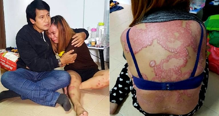 Thai Woman With Psoriasis Loses Her Husband and Job Over Fears She Has AIDS