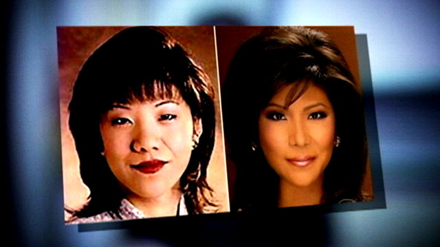 Julie Chen plastic surgery