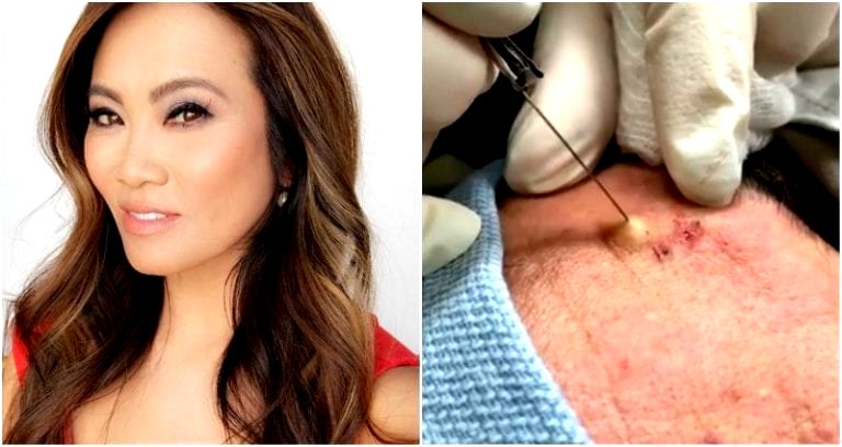 Dr. Pimple Popper is Getting Her Own Reality Series on TLC