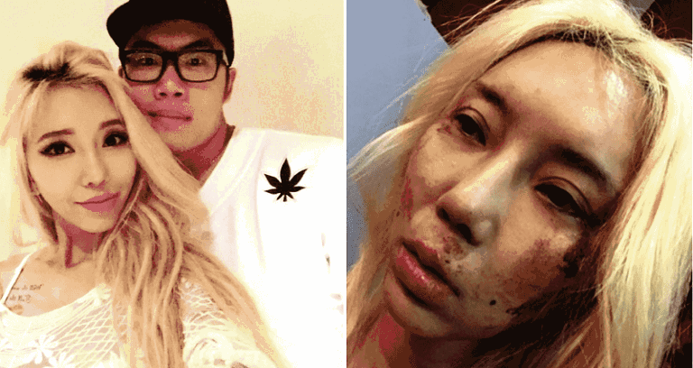 Top Malaysian DJ Posts Horrific Facebook Photos Accusing Boyfriend of Abuse