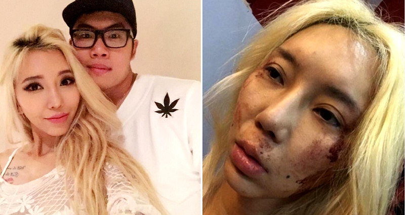 Top Malaysian DJ Posts Horrific Facebook Photos Accusing Boyfriend of Abuse