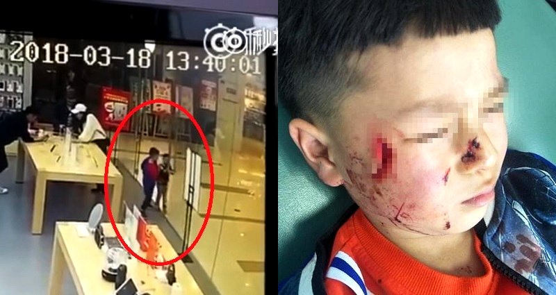 Boy in China Receives Stitches After Glass Door Explodes In His Face
