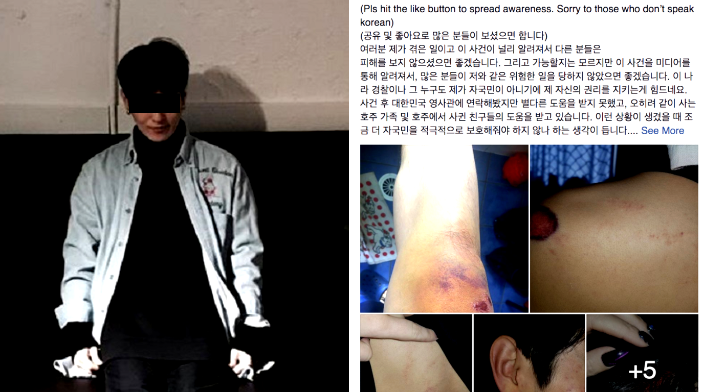 Korean Student Beaten By Drunk Man For Being Asian in Australia
