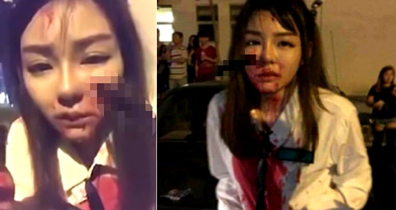 Brutal Robbery Leaves Teen in Malaysia With Knife Stuck in Her Face
