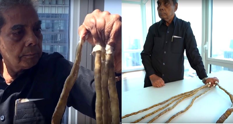 Man With The World’s Longest Fingernails Finally Decides To Trim Them After 66 Years